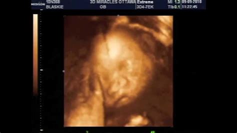 30 weeks pregnant 3d ultrasound - sayguy