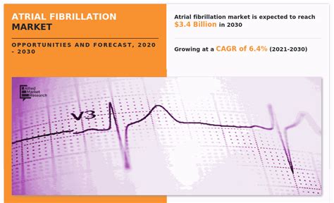 Understanding Atrial Fibrillation: Symptoms, Causes, and Treatment Options