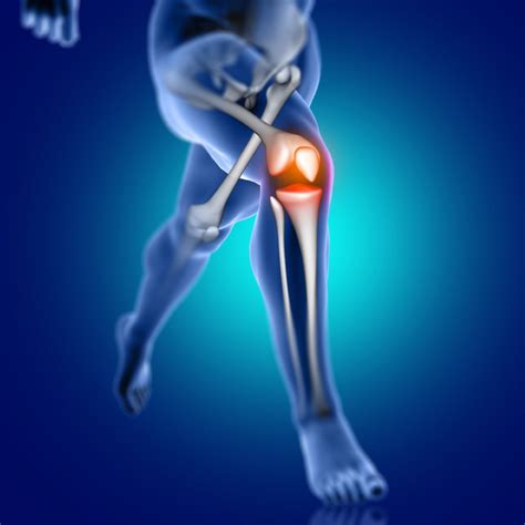 How to Diagnose Knee Osteoarthritis?