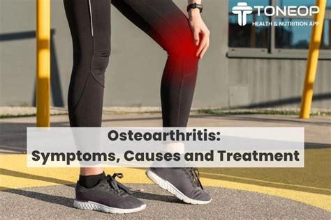 Osteoarthritis: Symptoms, Causes, and Treatment