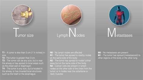 Stage 3 Lung Cancer : All that you need to know - Scientific Animations