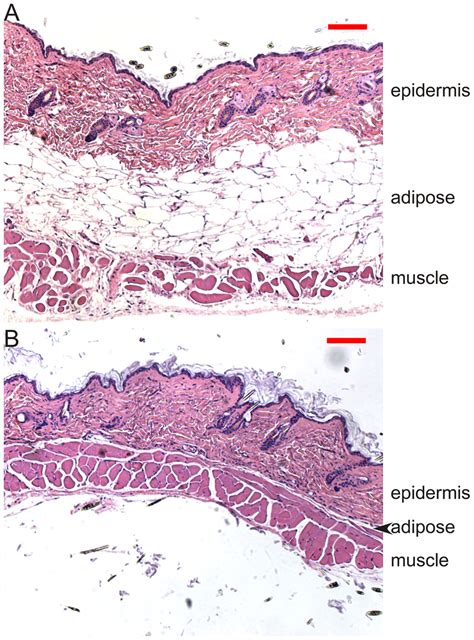 Skin Histology. Dorsal skin sections from HF control (A) and KO (B ...