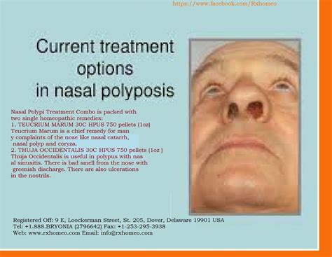 Health Homeopathy: Nasal Polypi Treatment Combo