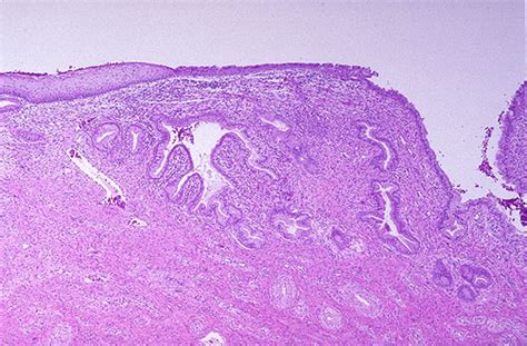 normal cervix histology