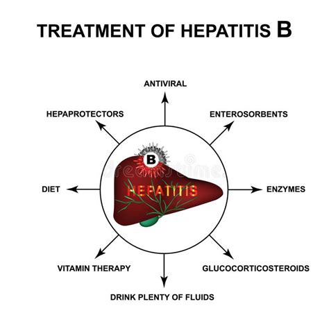 Treatment of Hepatitis B. World Hepatitis Day. Infographics. Vector ...