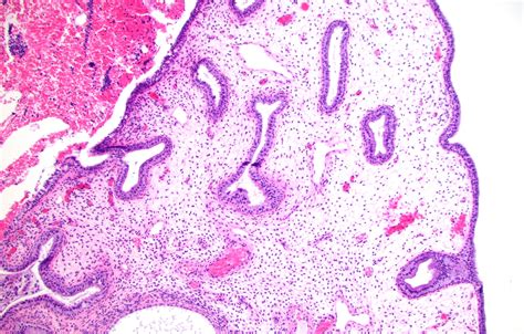 Endocervix Histology