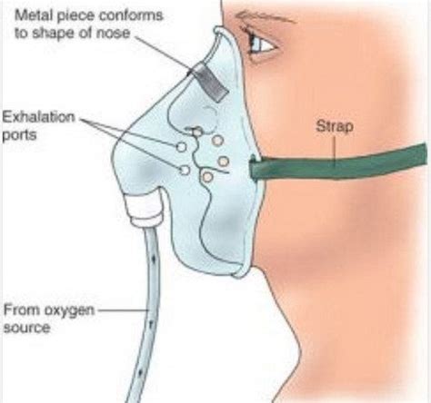 Non-rebreather mask Vs Partial rebreather mask Vs Simple mask | Simple ...