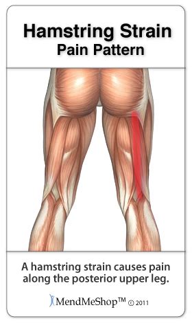 Symptoms of Hamstring Strain