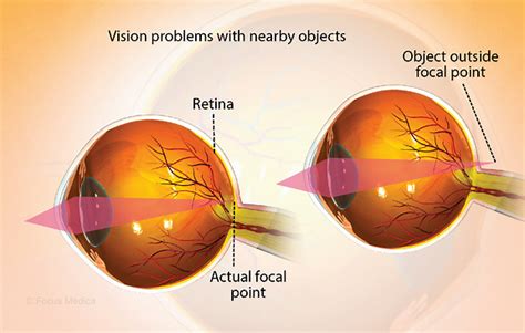 Health Symptoms : Causes, Treatment, Conditions and More