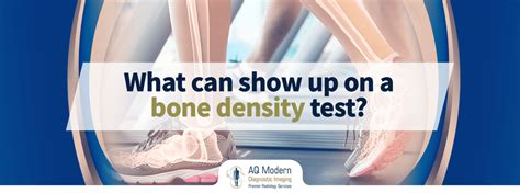 What can show up on a bone density test? AQMDI