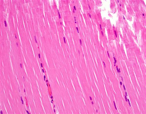 Smooth Muscle Vs Skeletal Muscle Histology