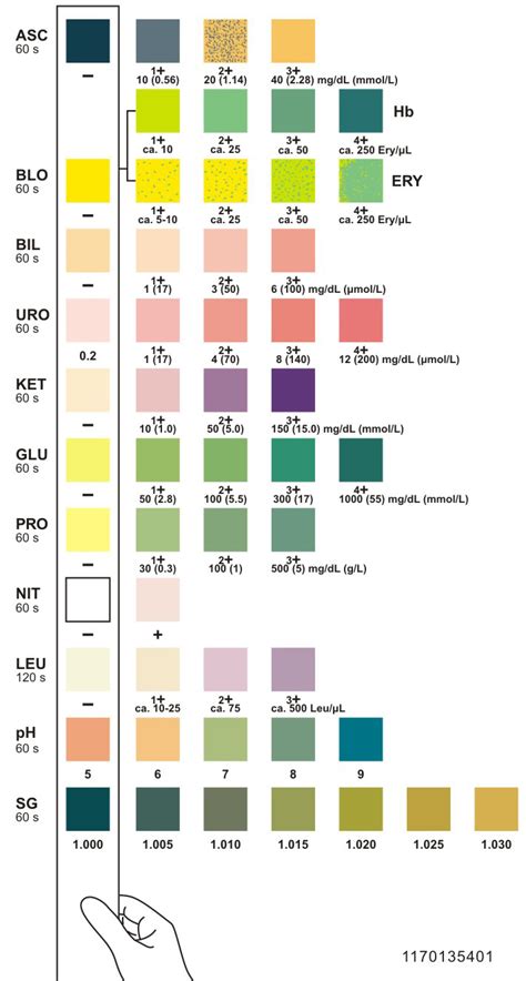 Urinalysis Test Strip Color Chart | Porn Sex Picture