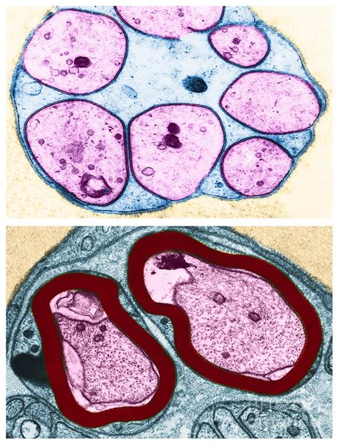 Unmyelinated And Myelinated Nerve Fibers Photograph by David M ...