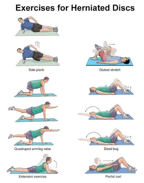 Best Exercise For Bulging Disc Lower Back - Exercise Poster