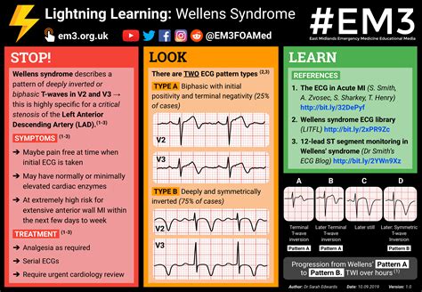 Wellens Syndrome [POSTER] : r/JuniorDoctorsUK