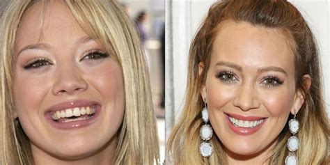 40+ Celebrities with Veneers - Body Art Guru