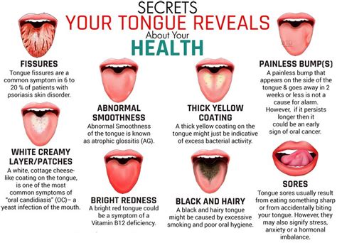 What Your Tongue Says About Your Health? | Astro Ulagam