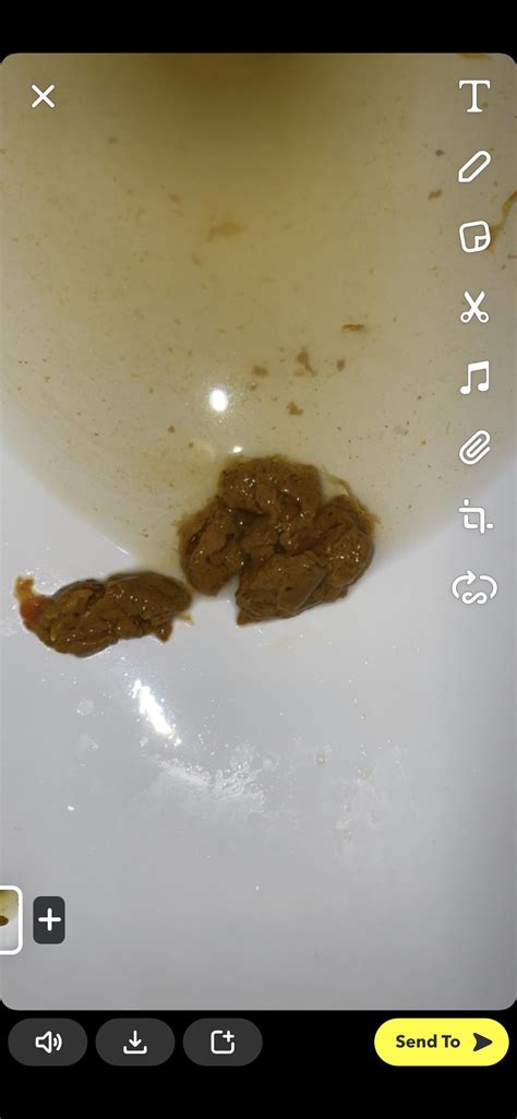 Does this look like fatty stool? : r/pancreatitis