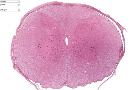 Spinal Cord Cross Section Histology Labeled