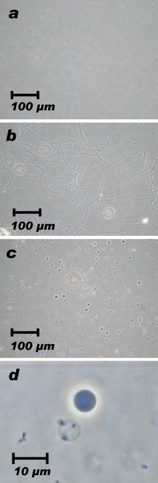 E. coli giant spheroplast preparation. | Download Scientific Diagram