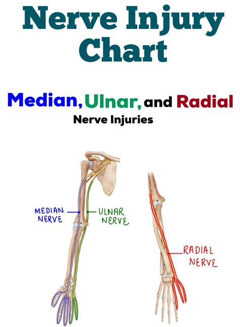 Nerve injury dysfunction chart median ulnar radial nerves – Artofit