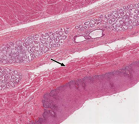 Pharynx, Esophagus, and Stomach | histology