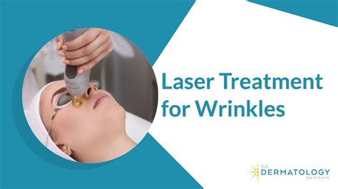 Laser Treatment for Wrinkles Removal - Oasis Medical Aesthetics