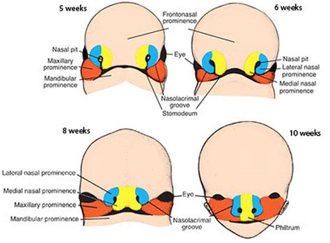 What Causes Cleft Lips and Palates? - EarWell Center of Excellence