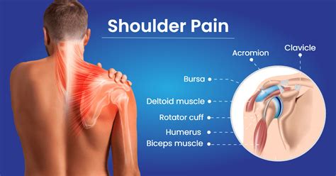 Shoulder Pain Doctor in Kansas | Shoulder Orthopedic Doctor