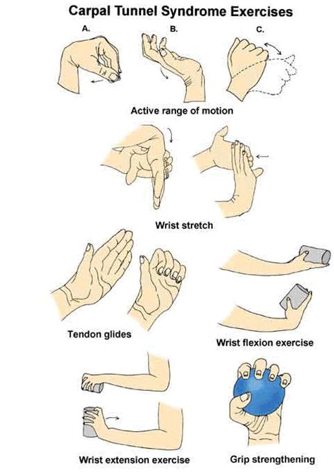 Hand Exercises For Carpal Tunnel Problems - Exercise Poster