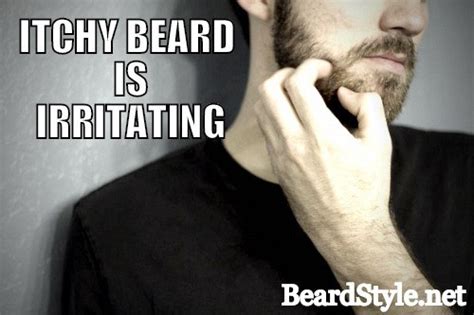 Itchy Beard: Causes and Remedies - Beard Style