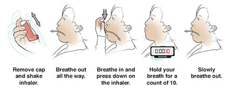 Discharge Instructions: Using a Metered-Dose Inhaler