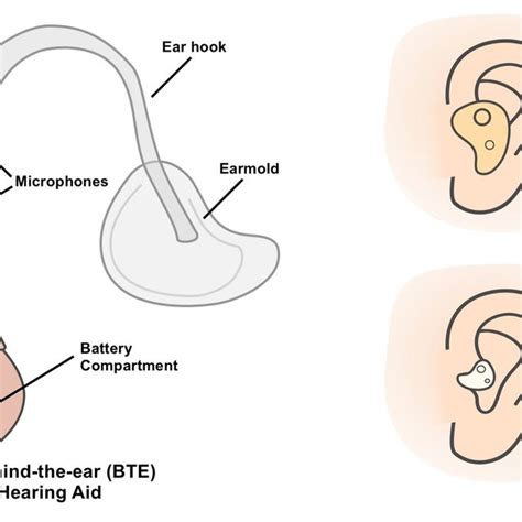 2: Diagram of dierent hearing aid styles: A) Behind the ear (BTE ...