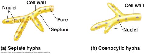 Septate and Coenocytic Hypha | Biology, Pearson education, Cell wall