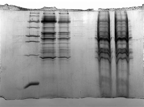 Membrane Protein Purification? | ResearchGate