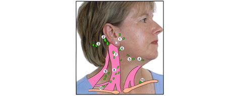 Enlarged Lymph Nodes In Neck