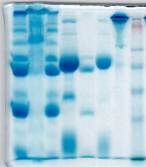 [Solved] Shown above is the SDS-PAGE gel results b) Results Table Use ...