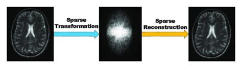 Application of Compressed Sensing in Magnetic Resonance Images (MRI) [4 ...