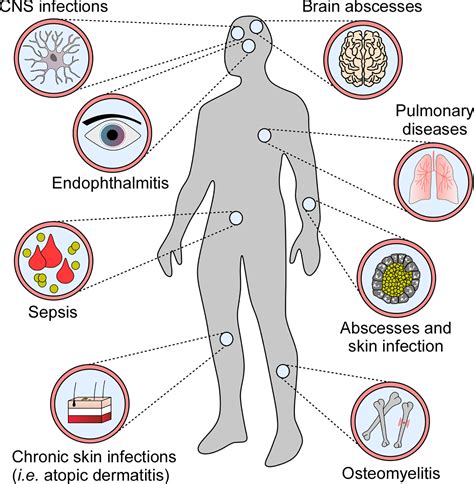 Mrsa Bacteria