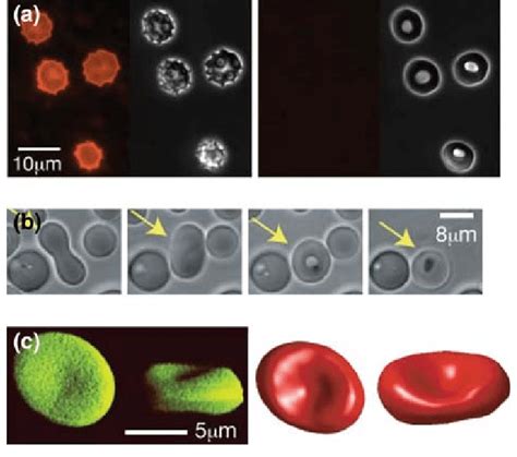 BSA alters lipid bilayer asymmetry and together with urea induces ...