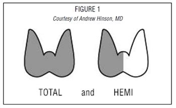 Thyroid Surgery | American Thyroid Association