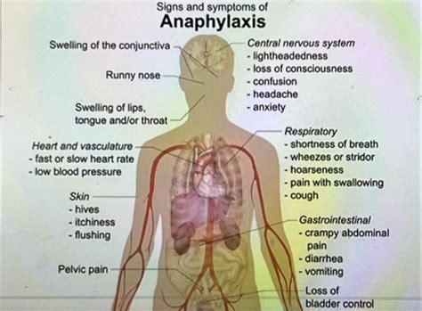 Hypersensitivity and Autoimmune Flashcards | Quizlet