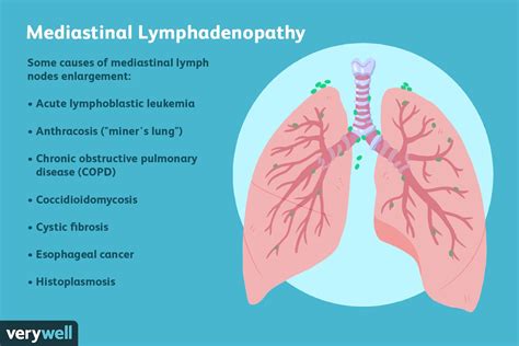 Mediastinal Lymphadenopathy