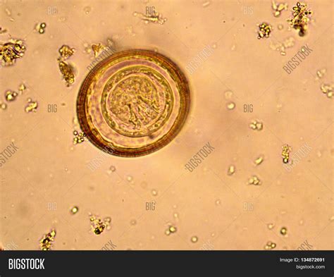 Egg Hymenolepis Image & Photo (Free Trial) | Bigstock