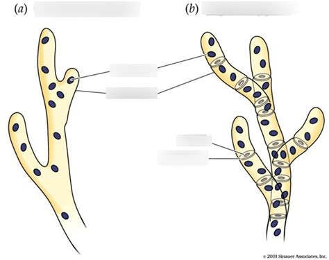 Fungi Diagrams, 3 different types of hyphae, Zygomycota asexual ...