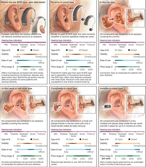 Widex Hearing Aid Parts Diagram