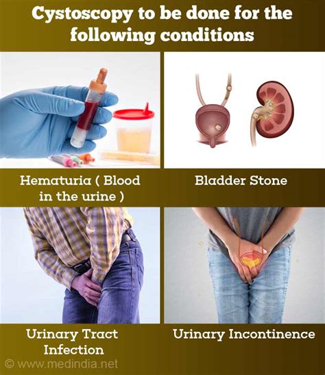 Cystoscopy - Purpose, Preparation, Procedure, Complications