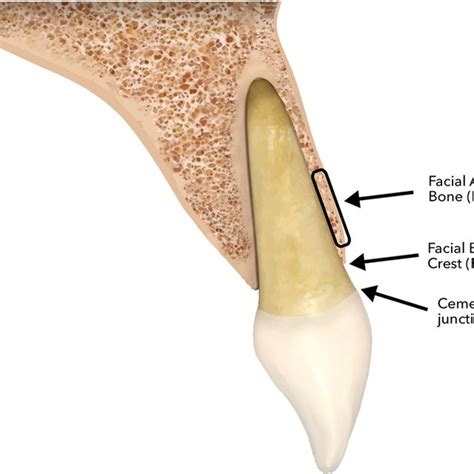 Alveolar Bone