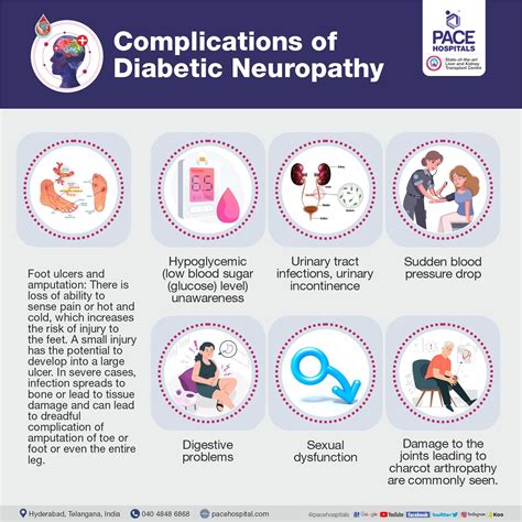 Diabetic Neuropathy – Causes, Symptoms, Complications & Treatment