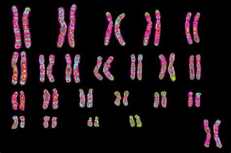 Karyotype | Description, Chromosome Aberration, & Uses | Britannica